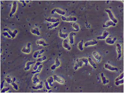 <mark class="highlighted">Naegleria</mark> fowleri outbreak in Pakistan: unveiling the crisis and path to recovery